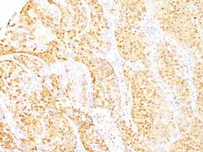 Immunohistochemistry-Paraffin: Arginase 1/ARG1/liver Arginase Antibody (ARG1/1125 + ARG1/1126) - Azide and BSA Free [NBP2-48000]