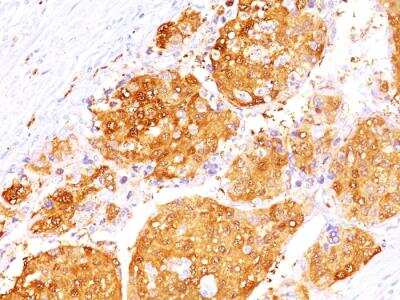 Immunohistochemistry-Paraffin: Arginase 1/ARG1/liver Arginase Antibody (ARG1/1125 + ARG1/1126) - IHC-Prediluted [NBP2-48255]
