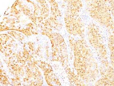 Immunohistochemistry-Paraffin: Arginase 1/ARG1/liver Arginase Antibody (ARG1/1125 + ARG1/1126) - IHC-Prediluted [NBP2-48255]