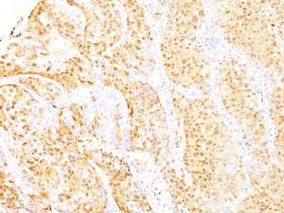 Immunohistochemistry-Paraffin: Arginase 1/ARG1/liver Arginase Antibody (ARG1/1125 + ARG1/1126) [NBP2-44967]