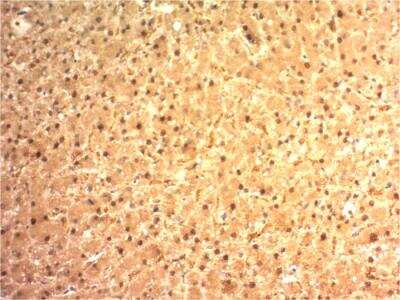 Immunohistochemistry-Paraffin: Arginase 1/ARG1/liver Arginase Antibody (ARG1/1125) - IHC-Prediluted [NBP2-48229]