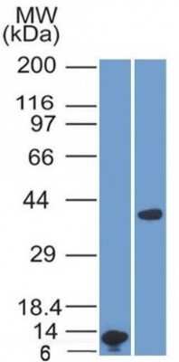 Western Blot: Arginase 1/ARG1/liver Arginase Antibody (ARG1/1125) [NBP2-44965]