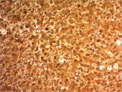 Immunohistochemistry-Paraffin: Arginase 1/ARG1/liver Arginase Antibody (ARG1/1126) - IHC-Prediluted [NBP2-48230]