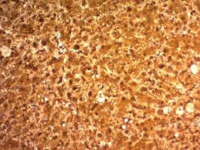 Immunohistochemistry-Paraffin: Arginase 1/ARG1/liver Arginase Antibody (ARG1/1126) [NBP2-44966]