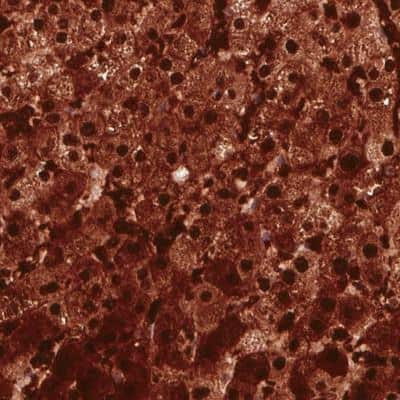 Immunohistochemistry-Paraffin: Arginase 1/ARG1/liver Arginase Antibody (CL0186) [NBP2-14787]