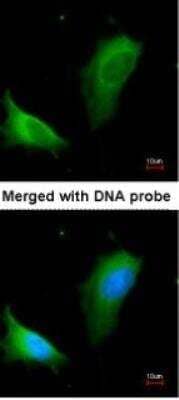 Immunocytochemistry/ Immunofluorescence: Arginase 1/ARG1/liver Arginase Antibody - BSA Free [NBP1-32731]