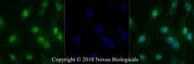 Immunocytochemistry/ Immunofluorescence: Arginase 1/ARG1/liver Arginase Antibody - BSA Free [NBP1-32731]