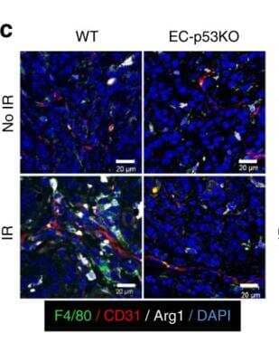 Immunohistochemistry: Arginase 1/ARG1/liver Arginase Antibody - BSA Free [NBP1-32731]