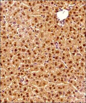 Immunohistochemistry-Paraffin: Arginase 1/ARG1/liver Arginase Antibody - BSA Free [NBP1-32731]