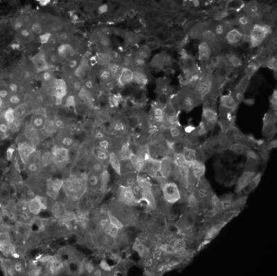 Immunohistochemistry-Paraffin: Arginase 1/ARG1/liver Arginase Antibody - BSA Free [NBP1-32731]