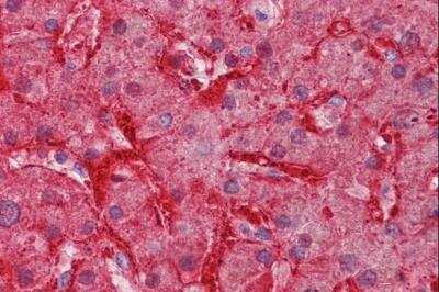 Immunohistochemistry-Paraffin: Arginase 1/ARG1/liver Arginase Antibody [NBP1-36936]