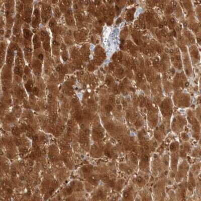 Immunohistochemistry-Paraffin: Arginase 1/ARG1/liver Arginase Antibody [NBP1-87455]