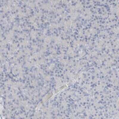 Immunohistochemistry-Paraffin: Arginase 1/ARG1/liver Arginase Antibody [NBP1-87455]