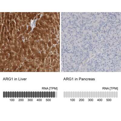 Immunohistochemistry-Paraffin: Arginase 1/ARG1/liver Arginase Antibody [NBP1-87455]