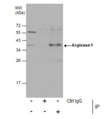 Immunoprecipitation: Arginase 1/ARG1/liver Arginase Antibody - BSA Free [NBP1-32731]