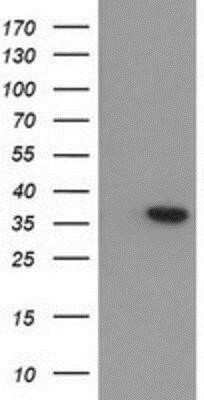 Western Blot: Arginase 1/ARG1/liver Arginase Antibody (OTI4E6)Azide and BSA Free [NBP2-70204]