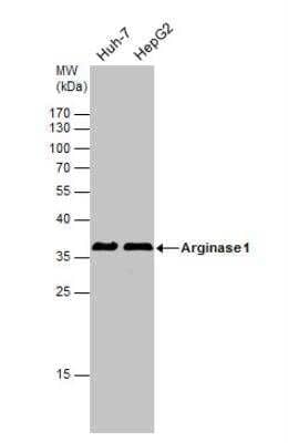 Western Blot: Arginase 1/ARG1/liver Arginase AntibodyBSA Free [NBP1-32731]
