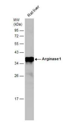Western Blot: Arginase 1/ARG1/liver Arginase AntibodyBSA Free [NBP1-32731]