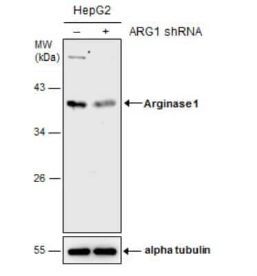 Knockdown Validated: Arginase 1/ARG1/liver Arginase Antibody - BSA Free [NBP1-32731]