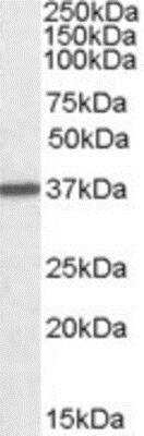 Western Blot: Arginase 1/ARG1/liver Arginase Antibody [NBP1-36936]