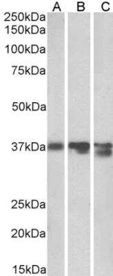 Western Blot: Arginase 1/ARG1/liver Arginase Antibody [NBP1-36936]