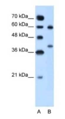 Western Blot: Arginase 1/ARG1/liver Arginase Antibody [NBP1-54621]