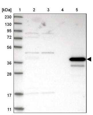 Western Blot: Arginase 1/ARG1/liver Arginase Antibody [NBP1-87455]