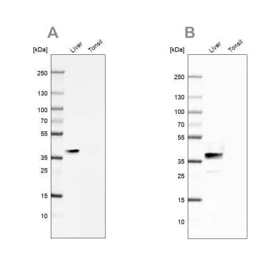 Western Blot: Arginase 1/ARG1/liver Arginase Antibody [NBP1-87455]