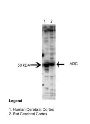 Western Blot: Arginine decarboxylase Antibody [NBP1-70403]
