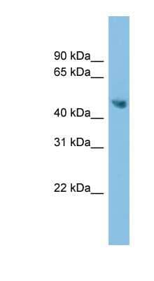 Western Blot: Arginine decarboxylase Antibody [NBP1-70403]