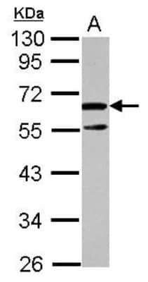 Western Blot: Arginine decarboxylase Antibody [NBP2-15447]