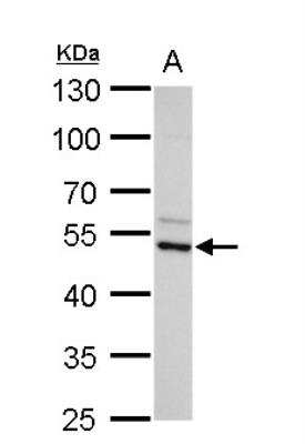 Western Blot: Arginine decarboxylase Antibody [NBP2-15447]
