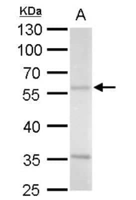 Western Blot: Arginine decarboxylase Antibody [NBP2-15447]