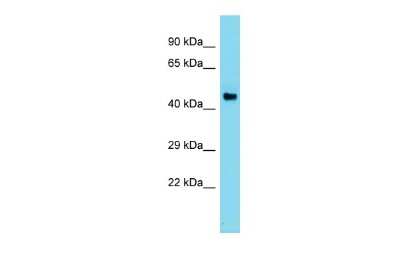 Western Blot: Arginine decarboxylase Antibody [NBP2-86579]