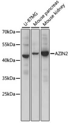 Western Blot: Arginine decarboxylase AntibodyAzide and BSA Free [NBP2-92283]