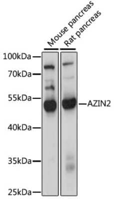 Western Blot: Arginine decarboxylase AntibodyAzide and BSA Free [NBP2-92284]