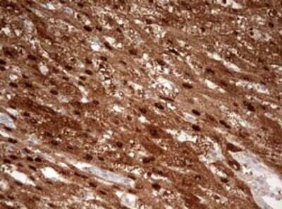 Immunohistochemistry: Argininosuccinate Lyase Antibody (OTI3D4) [NBP2-46548]