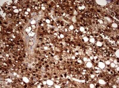 Immunohistochemistry: Argininosuccinate Lyase Antibody (OTI3D4) [NBP2-46548]