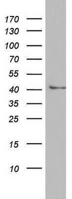 Western Blot: Argininosuccinate Lyase Antibody (OTI3D4) [NBP2-46548]