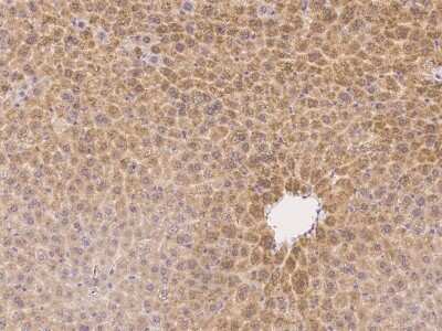 Immunohistochemistry: Argininosuccinate Lyase Antibody [NBP2-99442]