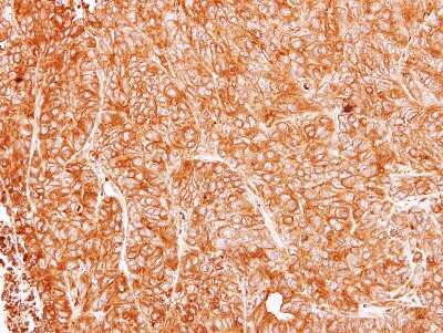 Immunohistochemistry-Paraffin: Argininosuccinate Lyase Antibody [NBP1-32752]