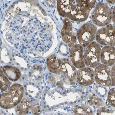 Immunohistochemistry-Paraffin: Argininosuccinate Lyase Antibody [NBP1-87462]