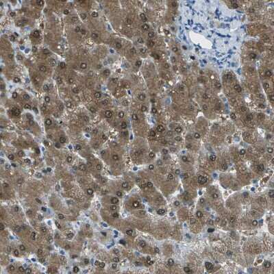 Immunohistochemistry-Paraffin: Argininosuccinate Lyase Antibody [NBP1-87462]