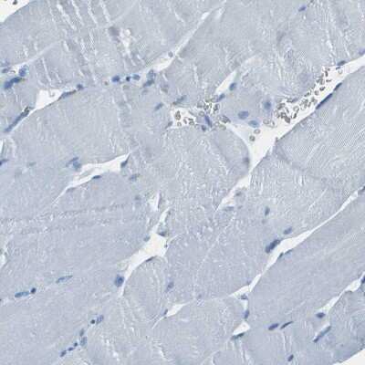 Immunohistochemistry-Paraffin: Argininosuccinate Lyase Antibody [NBP1-87462]