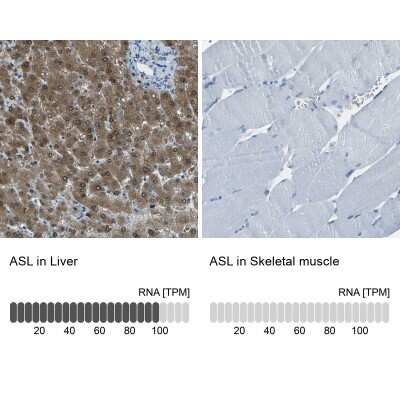 Immunohistochemistry-Paraffin: Argininosuccinate Lyase Antibody [NBP1-87462]