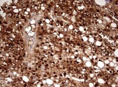 Immunohistochemistry: Argininosuccinate Lyase Antibody (OTI3D4) - Azide and BSA Free [NBP2-70213]