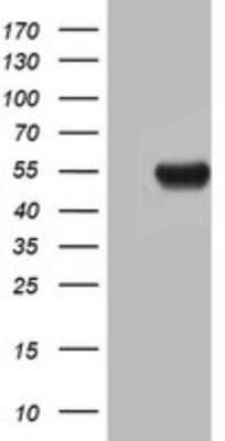 Western Blot: Argininosuccinate Lyase Antibody (OTI3D4)Azide and BSA Free [NBP2-70213]