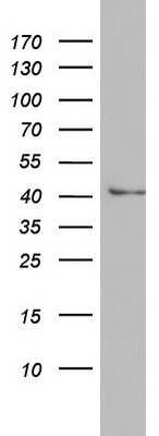 Western Blot: Argininosuccinate Lyase Antibody (OTI3D4)Azide and BSA Free [NBP2-70213]