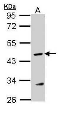 Western Blot: Argininosuccinate Lyase Antibody [NBP1-32752]