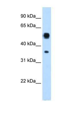 Western Blot: Argininosuccinate Lyase Antibody [NBP1-55124]